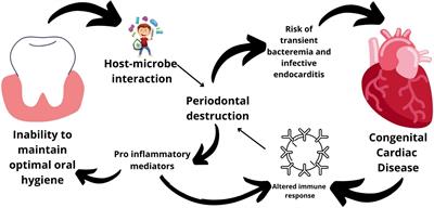 Congenital Heart Diseases and Periodontal Diseases—Is There a Link?